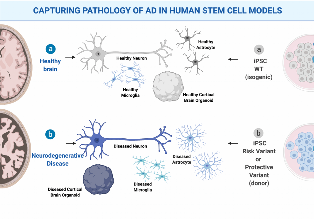 Capturing Pathology of AD in Human Stem Cell Models. The image depicts
1. A healthy brain producing healthy neurons, microglia, astrocytes and cortical brain organoids. 
2. A healthy stem cell donor that produces healthy neurons, microglia, astrocytes, and cortical brain organoids. 
3. A brain afflicted with neurodegenerative disease, such as Alzheimer's disease. This brain produces diseased neurons, microglia, astrocytes, and cortical brain organoids. 
4. A stem cell donor with a risk variant or protective variant also produces diseased neurons, microglia, astrocytes, and cortical brain organoids. 